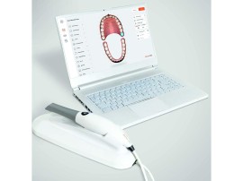 Meta Watches 