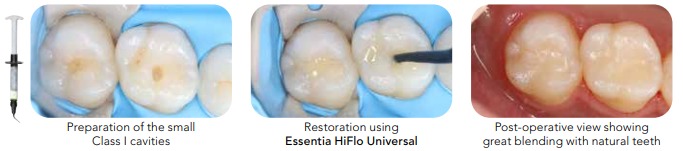 التقاط الويب_5-4-2023_5320_www.gc.dental.jpeg