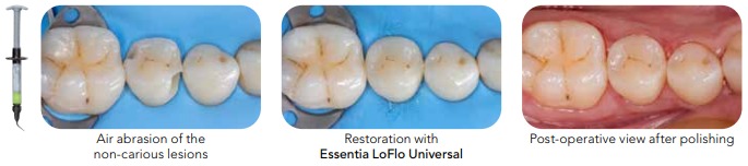 التقاط الويب_5-4-2023_53432_www.gc.dental.jpeg